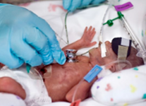 nicu baby being examined