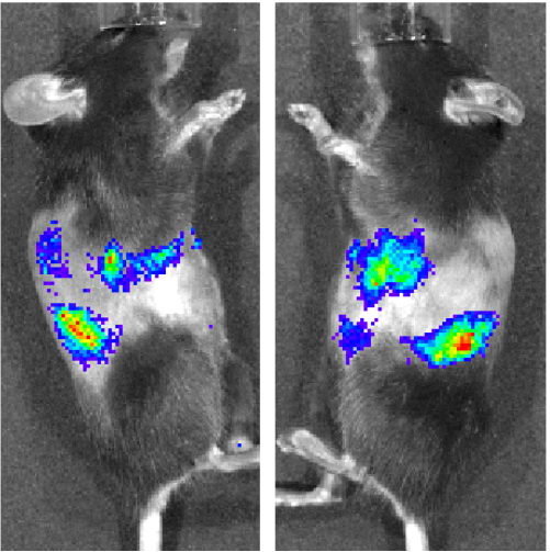 kidney targeted gene therapy