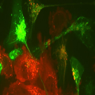 mechanism of hsc in cystinosis