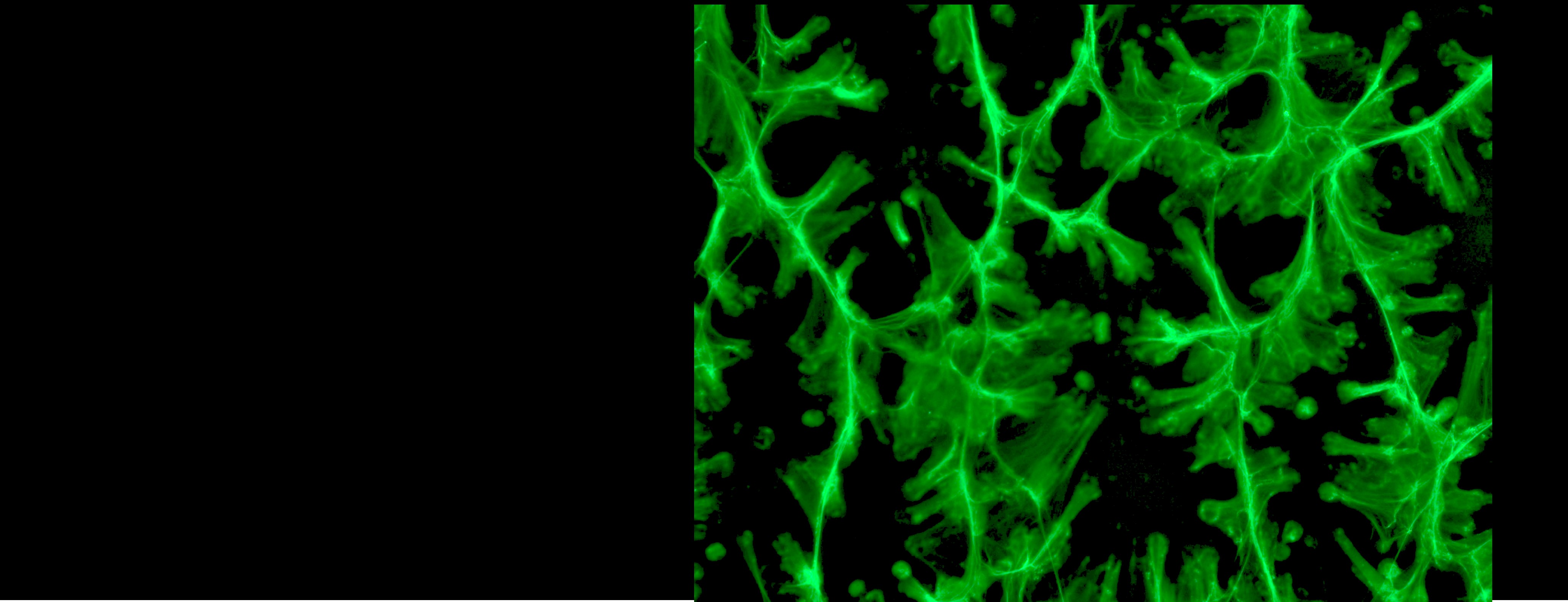 neutrophils making NETS