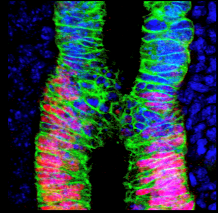 Microscopic image of lung 2