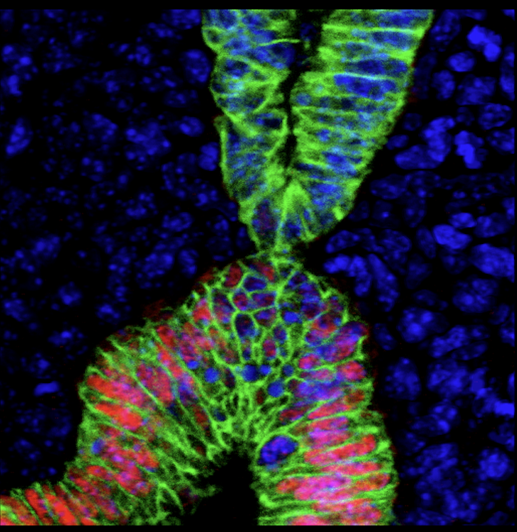 Microscopic image of lung