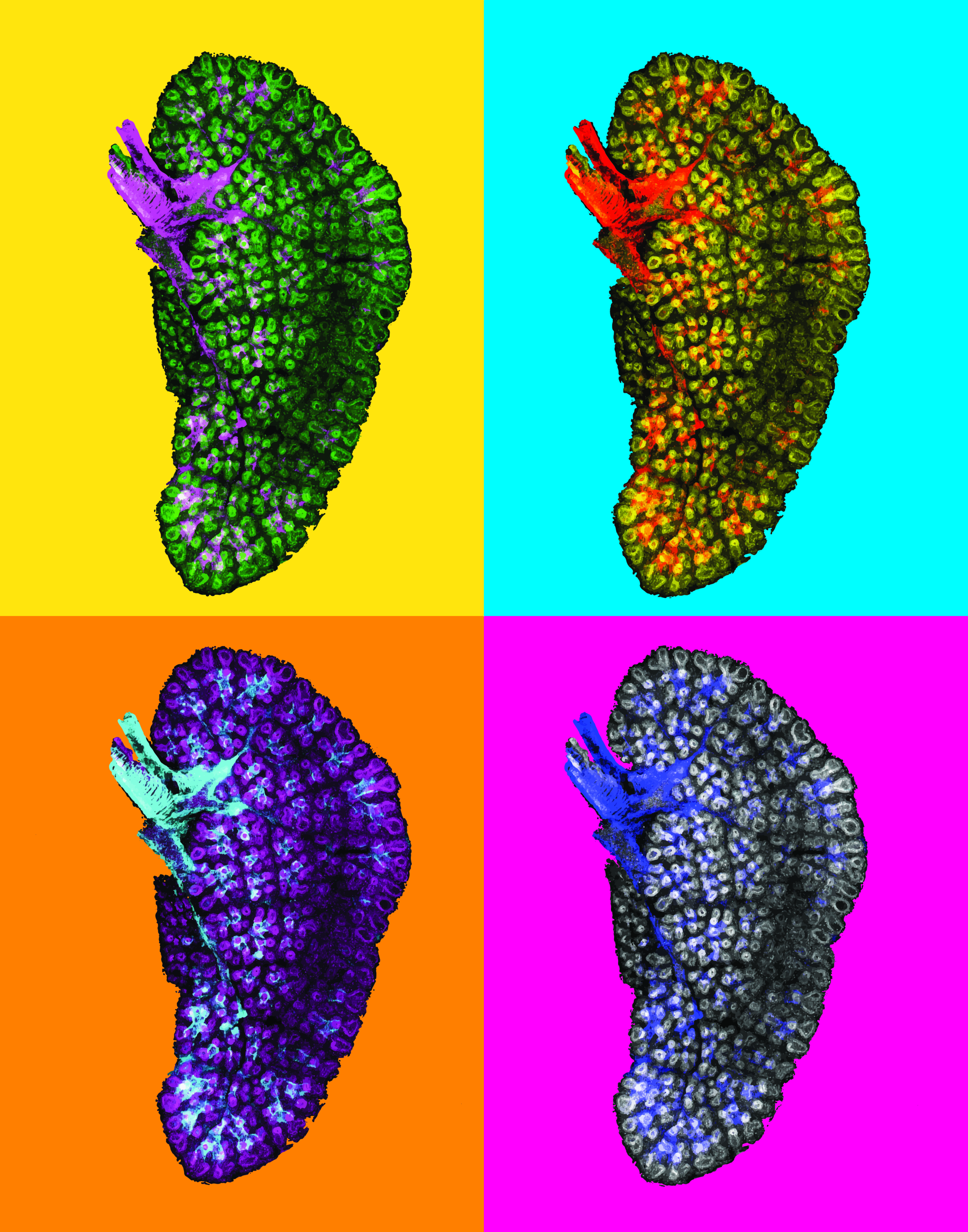 Mapping of lung samples