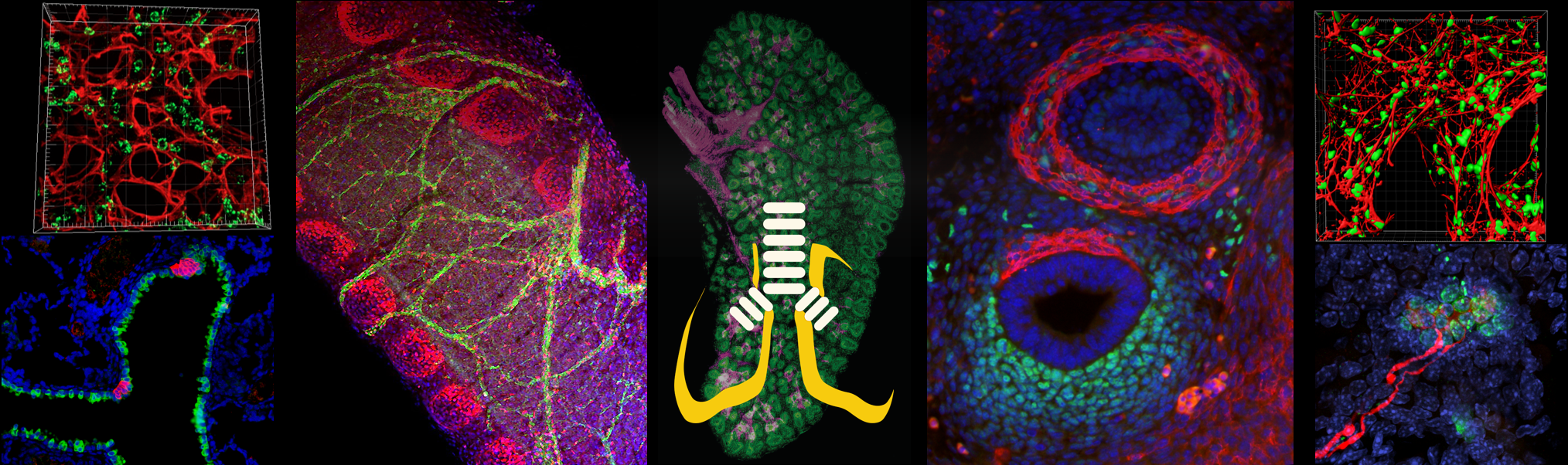 Microscopic views of lung matter from UCSD Lung Center